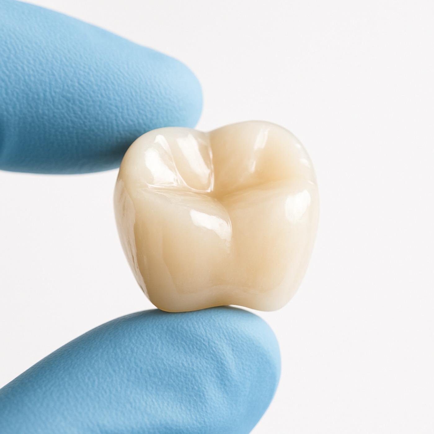 Porcelain Crowns